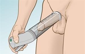 Andrology Treatment 2